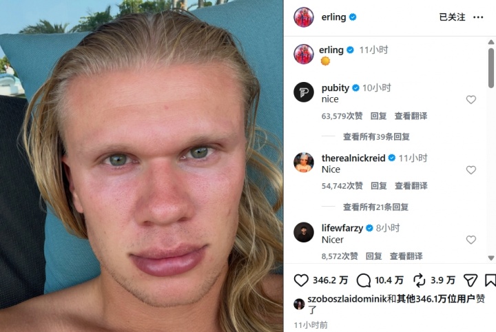哈兰德社媒晒度假自拍:躺椅+太阳,冲击力依旧 哈兰德社媒晒度假自拍:躺椅+太阳,冲击力依旧