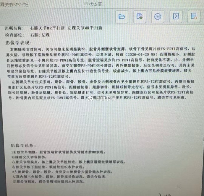 高诗岩双伤确认:右膝前交叉韧带+左踝 近期赴美康复 高诗岩双伤确认:右膝前交叉韧带+左踝 近期赴美康复
